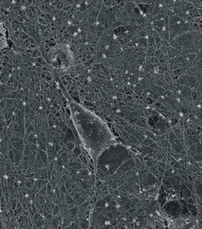 在純化碳納米管層上生長的培養大鼠海馬神經元的掃描電鏡顯微照片